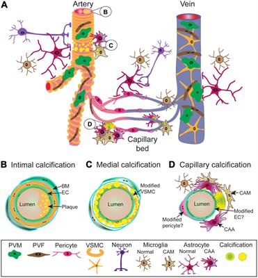 The Interplay Between Brain Vascular Calcification and Microglia